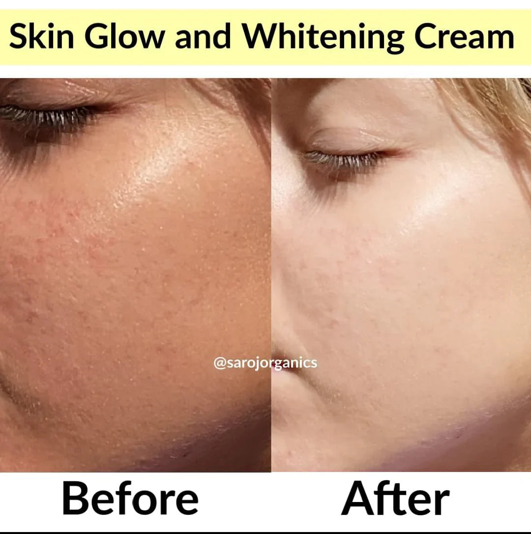 Zafrani Beauty Cream For Whitening & Glow + (Sale UpTo 70% OFF)